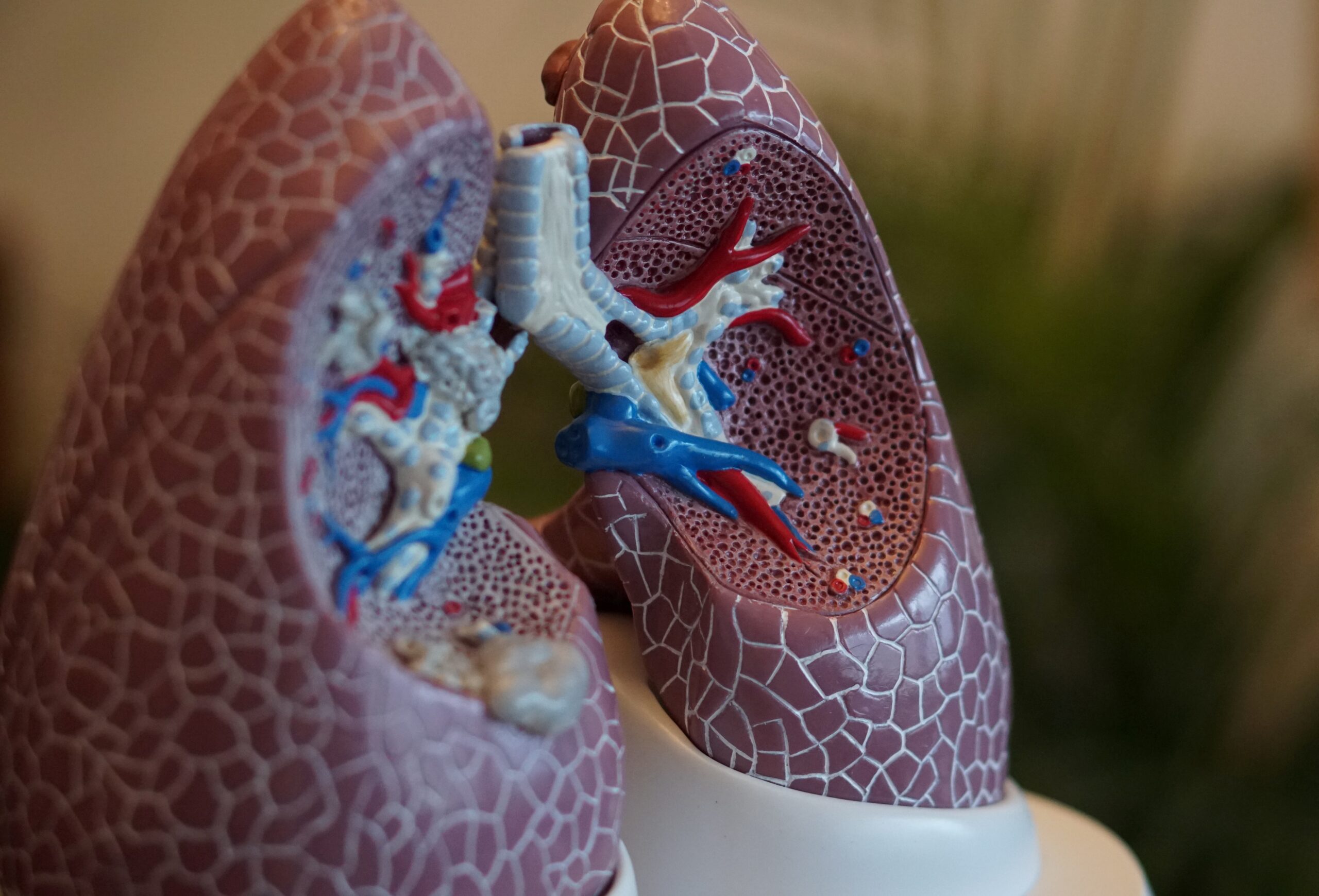 lung-cancer1